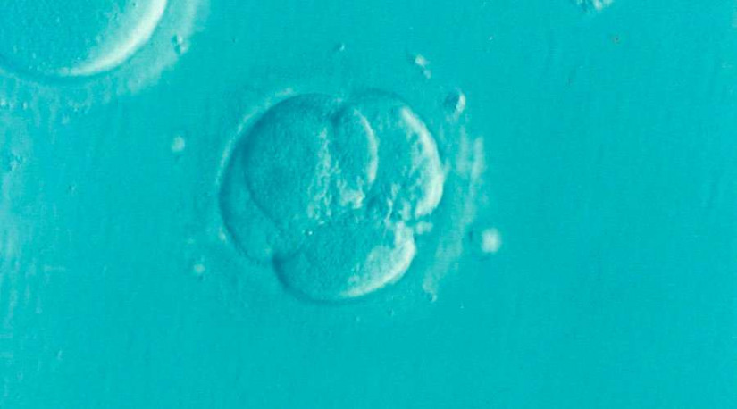 O embrião é o mais indefeso dos seres humanos e deve ser protegido, diz o bispo
